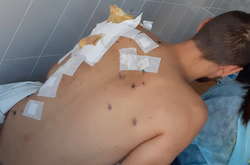 Росіяни почали використовувати проти українських воїнів безпілотники з бомбами