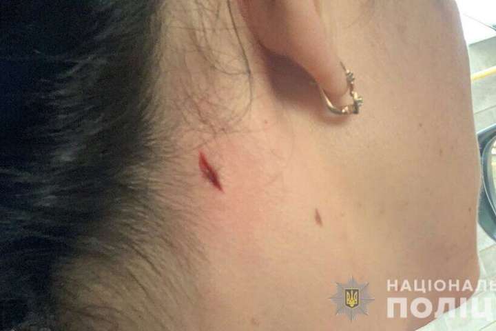 У Миколаєві біля поліцейського стрільбища поранили жінку