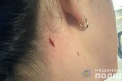 У Миколаєві біля поліцейського стрільбища поранили жінку