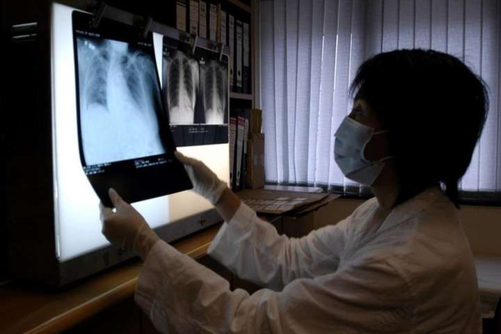 Вже понад 60 хворих на загадкову пневмонію зареєстровано у Китаї