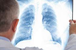 Пневмонія - небезпечне захворювання для всіх, але найбільше для дітей до 5-річного віку