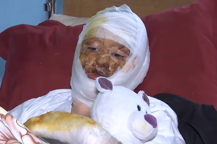 У Чернівцях батько облив бензином і підпалив власну дочку (відео)