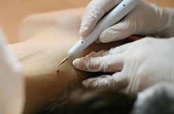 Онколог назвав єдиний ефективний спосіб захисту від раку