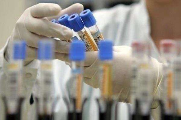 Столична влада запевнила, що київські лабораторії готові для діагностування коронавірусу