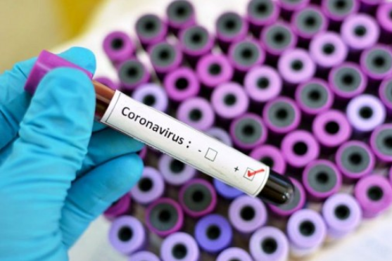В Одесі не зареєстровані випадки захворювання коронавірусом 2019-nCoV