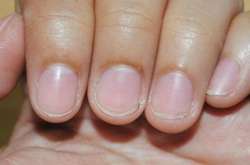 Лунула в формі півмісяця є частиною матриці нігтя, містить нерви, лімфу і кровоносні судини, а також виробляє клітини