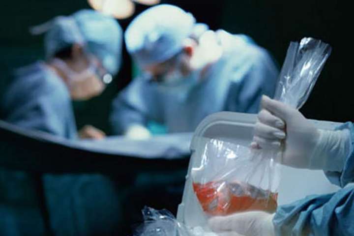 Трансплантація органів: У МОЗ пояснили, що змінюється з 2020 року