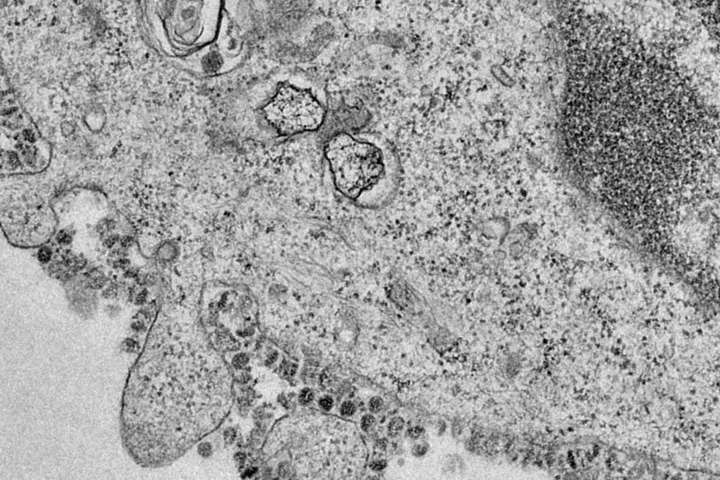 З'явилися перші знімки розмноження коронавірусу