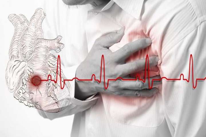 Пять продуктов, которые помогут предотвратить инфаркт