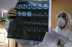 Від коронавірусу в Китаї за добу померли понад 140 осіб