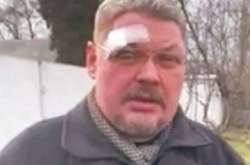 Пострадавший священник храма «Рождества Богородицы»