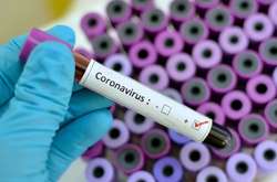 В Україні почали виробляти тести на коронавірус, – Данілов