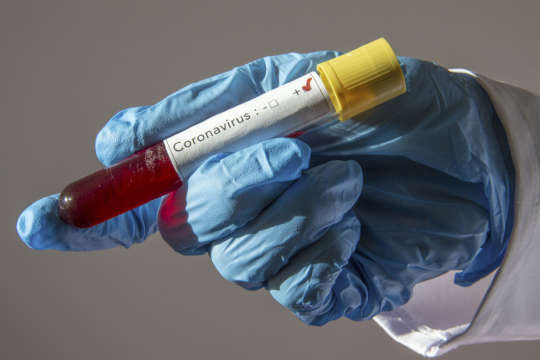 Епідемія коронавірусу: 2 442 людини померли, 22 888 – вилікувалися