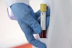  Станом на 23 лютого 2020 року у світі зареєстровано 78 817 лабораторно підтверджених випадків Covid-19, з них 2 462 – летальні. Одужало вже 23 232 осіб 