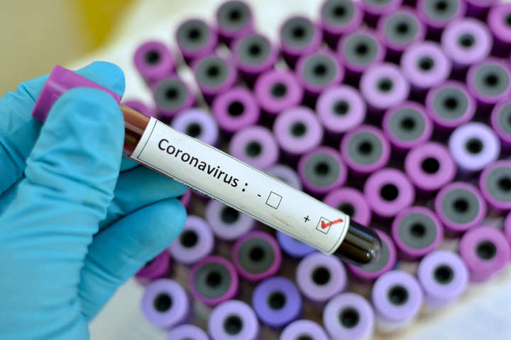 В Італії зафіксовано п'яту смерть від коронавірусу