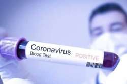 У Хорватії підтвердили перший випадок захворювання на коронавірус