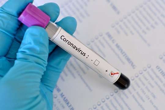 Перший випадок коронавірусу зафіксовано у Румунії