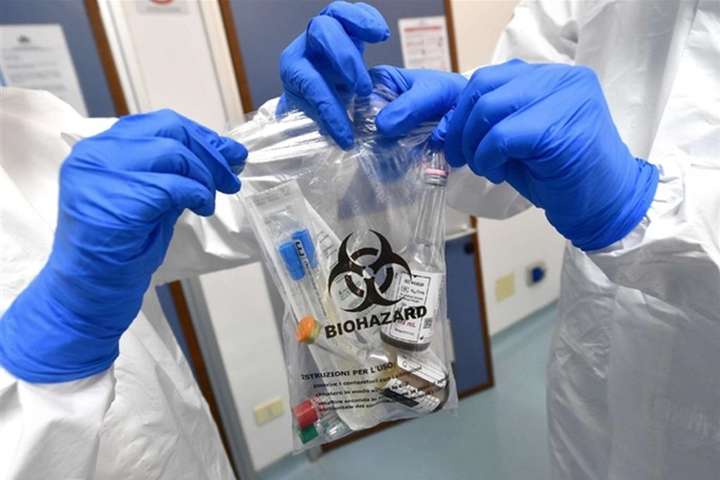 Україна отримає нові тести для виявлення коронавірусу за 15 хвилин