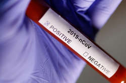 У Домінікані підтвердили перший випадок зараження коронавірусом