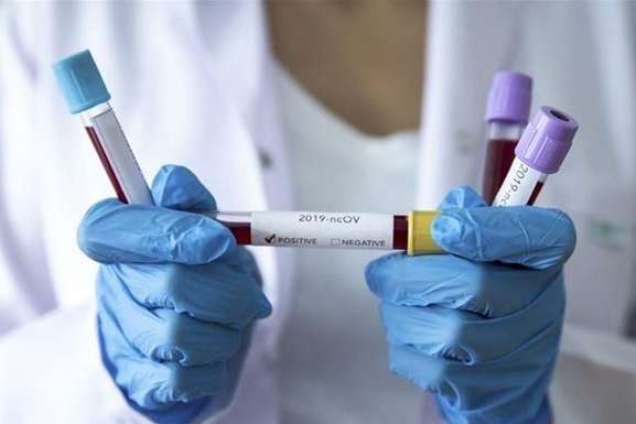 В Україні підтвердився перший випадок коронавірусу