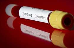 Садовий: у Львові досі немає тест-систем для діагностики коронавірусу