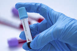 Від коронавірусу у світі вилікувалися 57 тис. людей, 3560 – померли