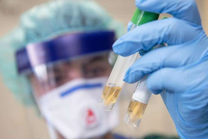 Центр громадського здоров’я України отримав 40 підозр на коронавірус