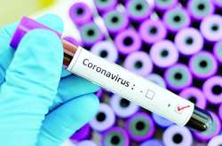 Украина получит дополнительные тесты на коронавирус