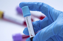 Туреччина заявила про перший випадок коронавірусу