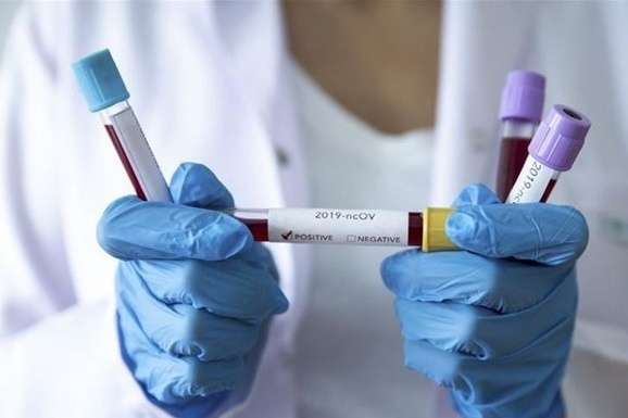 Лондонська лабораторія підтвердила коронавірус у жителя Чернівців