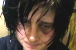 На Львівщині жорстоко побили та здійснили сексуальне насильство щодо сироти