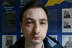 У Києві напали на головного лікаря інституту раку 