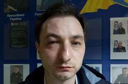 Неизвестные избили главврача Института рака