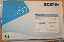 На Вінниччину доставили перші експрес-тести для виявлення коронавірусу