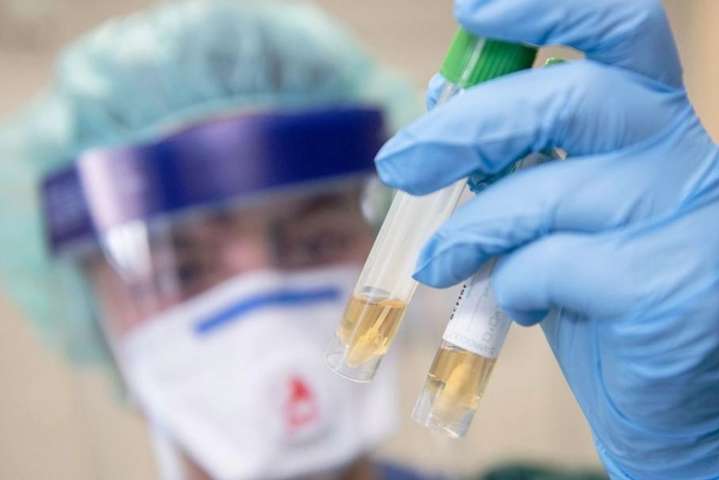 Коронавірус у Чернівцях: медики розповіли про стан двох інфікованих