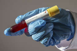 Український дипломат за кордоном захворів на коронавірус, – Кулеба