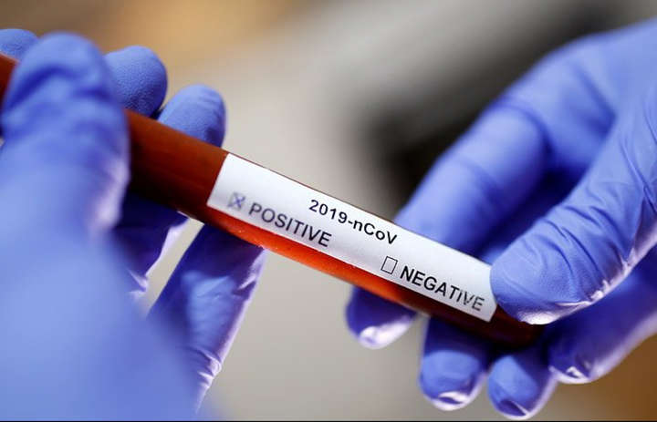 У США кількість інфікованих коронавірусом перевищила 2,7 тисячі осіб