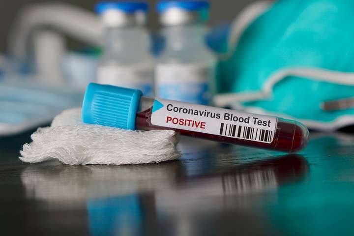 У ЦАР зафіксували перший випадок зараження коронавірусом