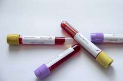 За межами України зареєстровано 12 випадків зараження українців коронавірусом