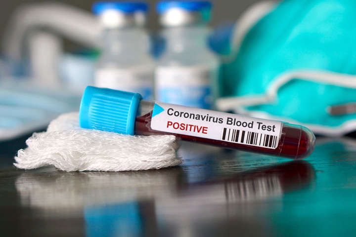 Перший випадок коронавірусу на Київщині: подробиці про хворого