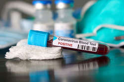 Вірус деглобалізації