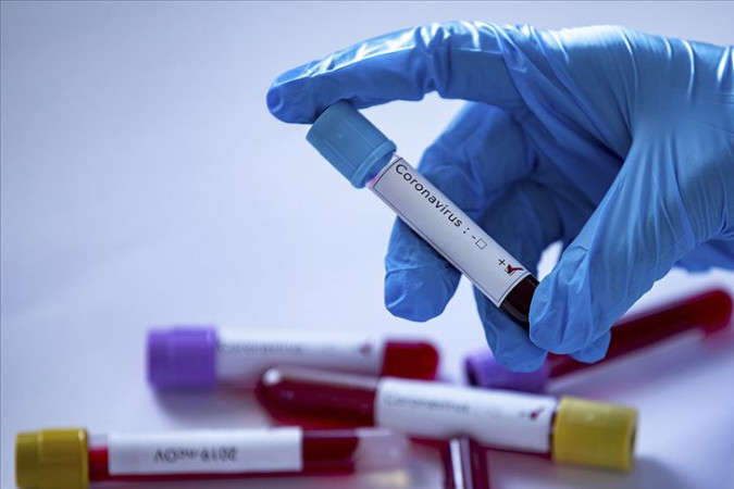 За день в Украине зафиксировано 79 подозрений на коронавирус