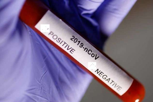 За тиждень киянам зроблено понад 200 експрес-тестів на коронавірус