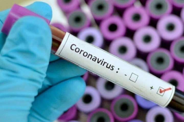 На Дніпропетровщині виявили перші два випадки коронавірусу