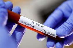 Кількість хворих коронавірусом в Україні перевищила 20