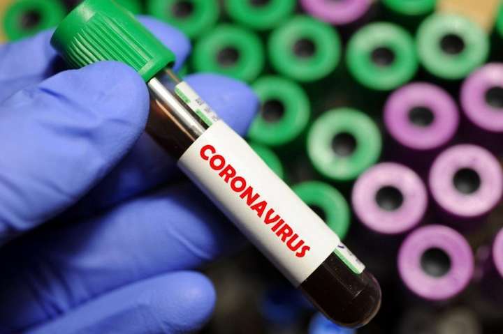 В Україні підтвердили вже 41 випадок коронавірусу