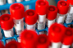 Всього було зафіксовано 11 149 нових випадків зараження і 509 нових смертей