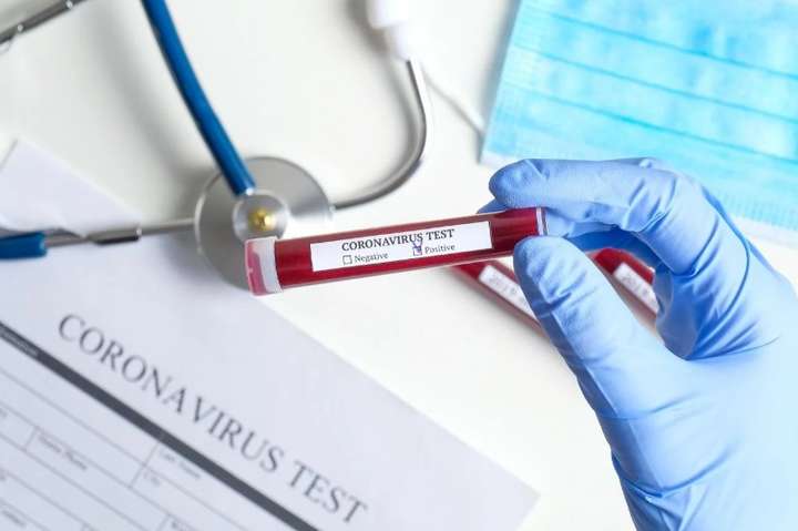 В Україні за добу виявлено 16 нових випадків зараження коронавірусом