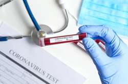В Україні за добу виявлено 16 нових випадків зараження коронавірусом