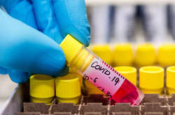 26 випадків за добу: кількість інфікованих Covid-19 в Україні зросла до 73